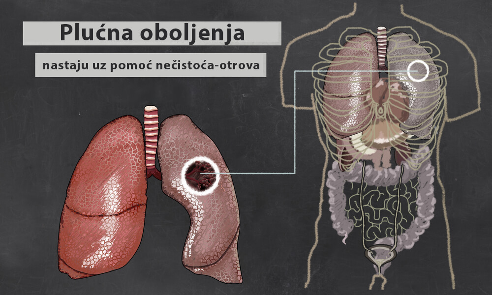 bolesti pluca narkomanija