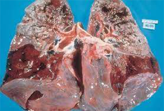 Lung diseases - Dr Vorobjev