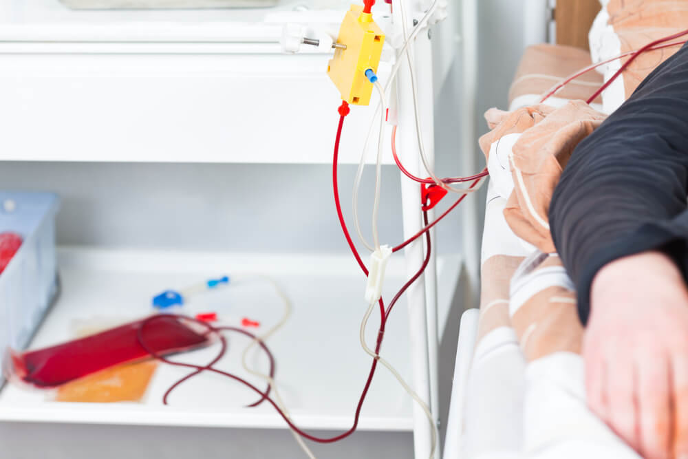 Plasmapheresis – contemporary detoxification method