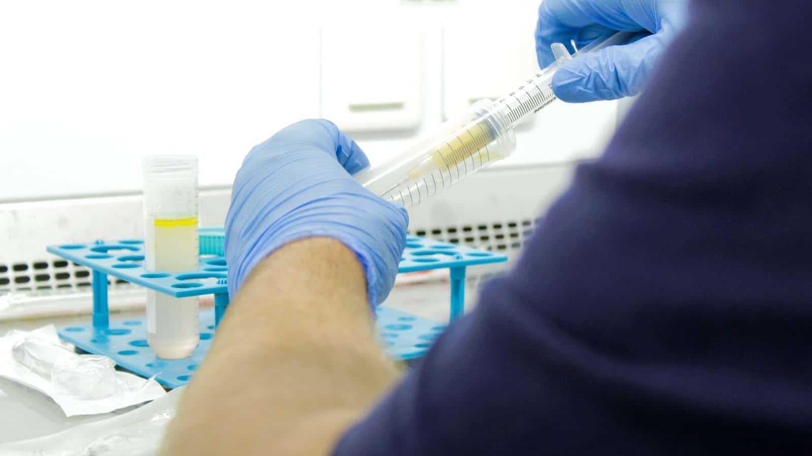Lekar započinje proces medicinske detoksikacije.